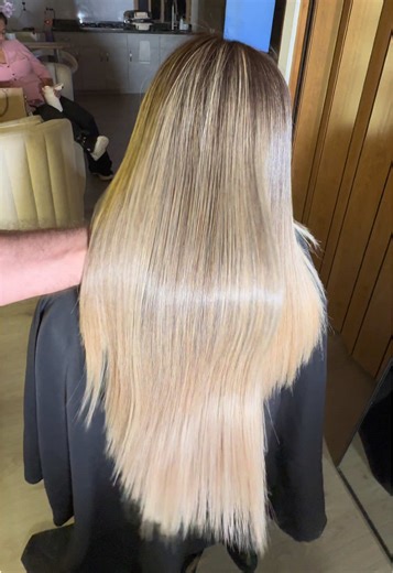 Cirugía capilar: resultados increíbles y duraderos