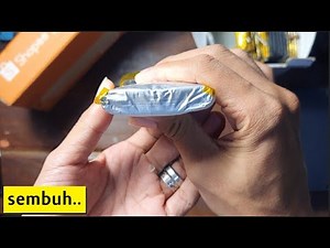 Cara Memperbaiki Baterai Kembung Secara Alami