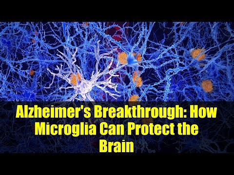 Alzheimer's Breakthrough: How Microglia Can Protect the Brain | PU.1 & CD28 Explained