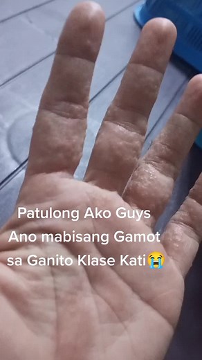 Kati Sa Buo Kamay At Daliri #mabisanggamot #anyadvice #anysuggestions #katiktokfamily