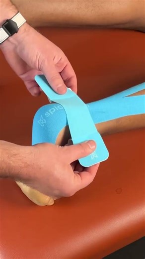 Taping For Achilles Tendonitis. Comment "Tape" Below To Unlock Our Masterclass.