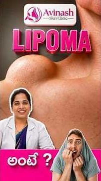 🔍 Lipoma Explained | Causes, Symptoms & Treatment Options | When Should You Remove a Lipoma?