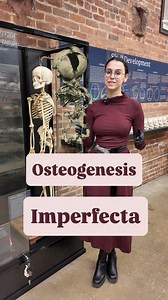 7.7K views · 10K reactions | What causes bones to break so...