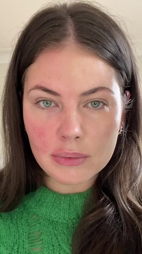 Color Correcting Method for Rosacea Coverage