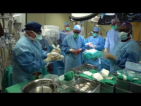 Jewish Hospital team performs first-in-world artificial heart transplant in female patient