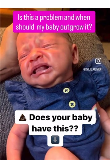 This stage doesn’t last forever, even though it can feel like it will in the moment 💛 Newborn (infant) dyschezia usually: • starts in the first weeks of life • improves as babies learn coordination • resolves on its own by about 2–4 months For most babies, time is the only thing they need. If the straining and distress continue past 6 months, or stools become hard, bloody, or your baby seems uncomfortable outside of pooping, that’s no longer typical—and it’s important to talk with your pediatri