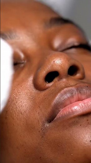 “Giant Clogged Pores Cleared in Seconds!”