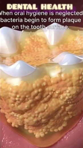 Dental Plaque Development in 3D Animation | How Plaque Forms on Teeth