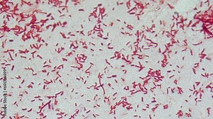 Red bacterial cells under microscope magnification on glass, a fixed sample of bacterial culture.