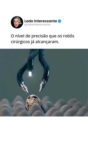 Lado Interessante on Instagram: "A demonstração pode parecer simples, mas revela algo impressionante sobre a evolução da tecnologia. Controlados por sistemas avançados, esses robôs conseguem executar movimentos minúsculos com uma estabilidade que mãos humanas dificilmente alcançam. Cada ação é calculada em tempo real, eliminando tremores e reduzindo margens de erro a níveis quase imperceptíveis. Esse nível de controle não surge por acaso. Sensores de altíssima precisão, softwares inteligentes e