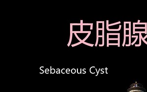 皮脂腺囊肿 Chinese Pronunciation Sebaceous cyst