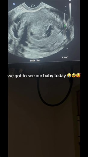 Exciting Baby Scan Update at 8 Weeks and 5 Days