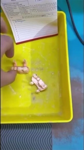 #exocad #dental #digital #design