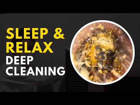 Extreme Ear Cleaning with Calming Music | Deep Relaxation & Sleep