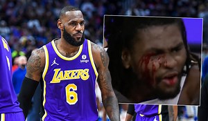 Watch: LeBron James ejected after leaving opponent bloodied in nasty NBA brawl - Extra.ie
