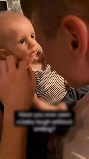 Moebius syndrome in babies #fbreelsfypシ゚ #moebiussyndrome | Viral Side