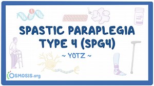 Spastic paraplegia type 4 (SPG4): Year of the Zebra 2025: Video, Causes, & Meaning | Osmosis