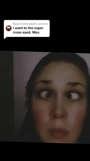 Understanding Crossed Eyes Phenomenon