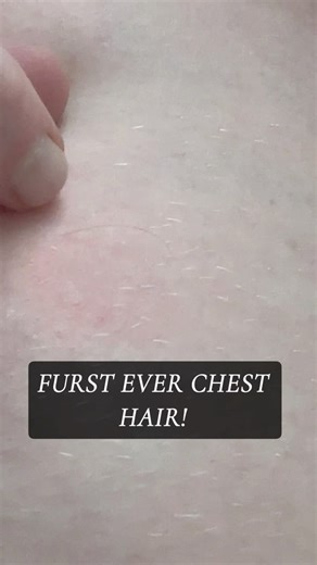 28 years of life and my first ever chest hair 🤣