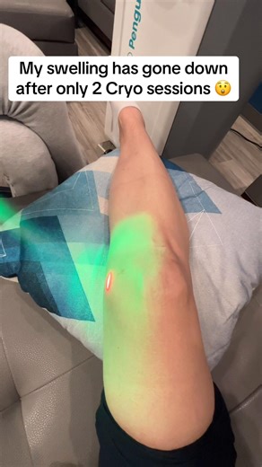 Localized Cryo Therapy for Knee Swelling Relief