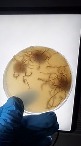 I Cloned Parasitic Alien Fungus #fbreels #reelsfb #aliens #fungus #nature #foraging #scienceexperiment #spores #biology #weird #parasites #wildmushrooms #mushlove #viralreelsfacebook #reelsvideo | Spore n’ Sprout