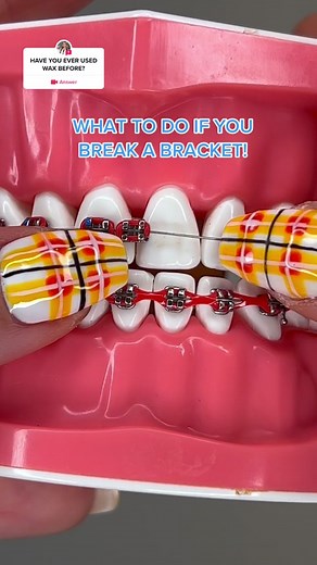 Braces By Britt Official® on TikTok