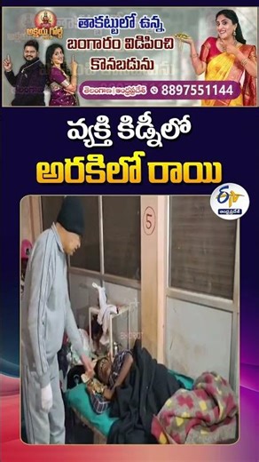 Half-Kilogram Stone in Man's Kidney | MP