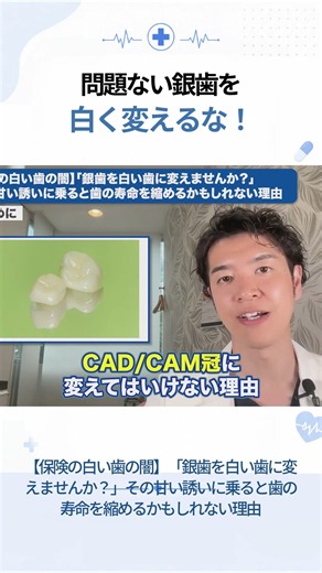 問題ない銀歯を 白く変えるな！