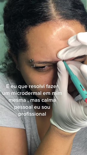 DIY Microdermal Piercing: Step-by-Step Tutorial