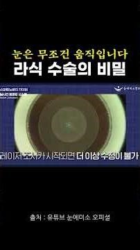 The Secret of SMILE LASIK Surgery