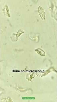 Como é a urina no microscópio? Exame de urina! #análisesclínicas #laboratorio #biomedicina