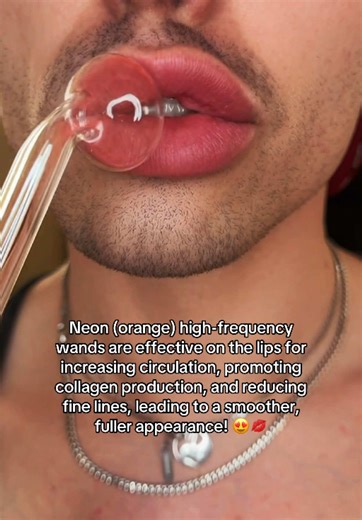 Pucker up, buttercup! Neon high frequency on the lips boosts circulation, plumps, and rejuvenates. Say goodbye to lines and hello to youthful lips! This kit includes three Neon wands for anti-aging and three Argon wands to fight acne. Get yours now! 💋 #highfrequency #antiaging #acnetreatment #liptreatment
