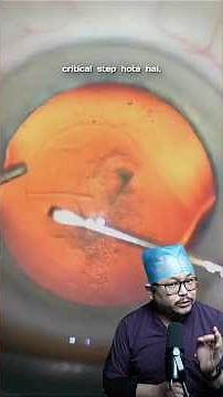 CCC in Cataract Procedure – Small Step, Big Impact