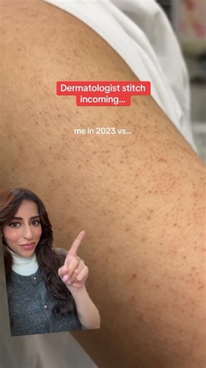 124K views · 1.4K reactions | Bye strawberry skin  from rough & bumpy to smooth and silky in 3 easy steps 來 #dermatologist #skincare #skincareproducts #keratosispilaris #bumpyskin #roughskin #bodyskincare #bodycare #showerroutine #everythingshower #kp @cerave @theordinary @ameliorateskin @naturium | Dr Aamna Adel | Facebook