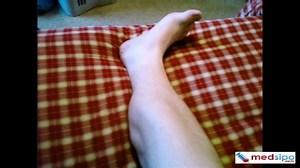 Ionized Calcium Test (Risk Factors, Normal Range, Results Interpretation)