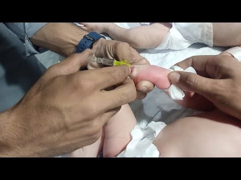💉 IV Line Insertion Procedure in Newborn Baby | NICU Care Step-by-Step Guide 👶