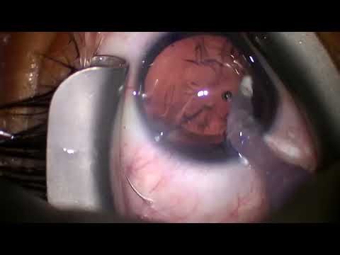 2025 10 09 125656 Panoptix Pro