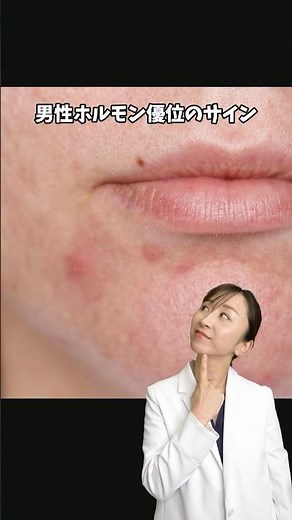 【知ってた？】男性ホルモンが優位になると起こりやすい症状