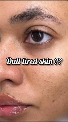 ✨ Get Glowing Skin INSTANTLY with this DIY Turmeric Face Mask! #Shorts