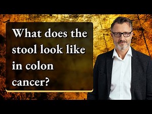 What does the stool look like in colon cancer?