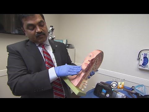 Anything But CPAP: Other Sleep Apnea Treatment Option