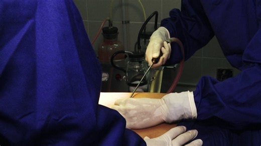 Brasil é recordista mundial com 1,5 milhão de cirurgias plásticas ao ano - Parte 1