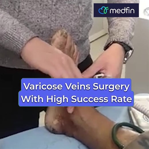 Medfin offers advanced non-surgical Varicose Vein treatments in Bangalore ☎️ Call us-08045681448 ✅ 50000 happy customers ✅ 15 Yrs experienced surgeons ✅ 𝐀𝐥𝐥 𝐈𝐧𝐬𝐮𝐫𝐚𝐧𝐜𝐞 𝐀𝐜𝐜𝐞𝐩𝐭𝐞𝐝 ✅ Day-Care Procedure ✅ End to end Patient care ✅ Pay in Instalments ✅ Free Pickup & drop service | Medfin