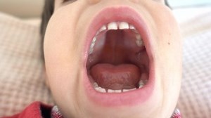 4k Condition Milk Teeth Mouth Child Stock Footage Video (100% Royalty-free) 1048612639 | Shutterstock