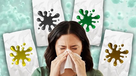 When your snot colour is cause for serious concern - as 'super flu' surges 18%