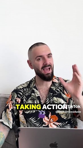 Understanding Mature vs. Receding Hairline Differences