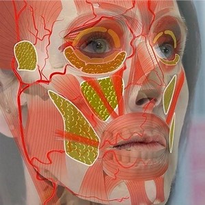 Botulinum Toxin Complications BOTOX® eLearning | Dr Tim Pearce