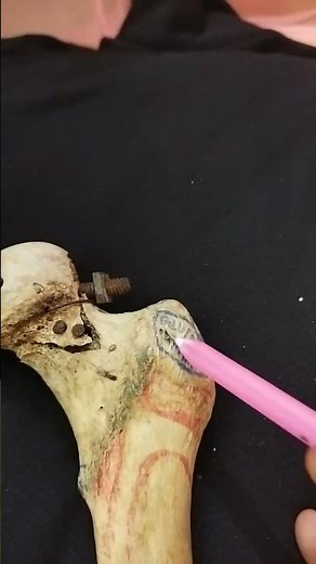 Osteology : Greater trochanter of femur