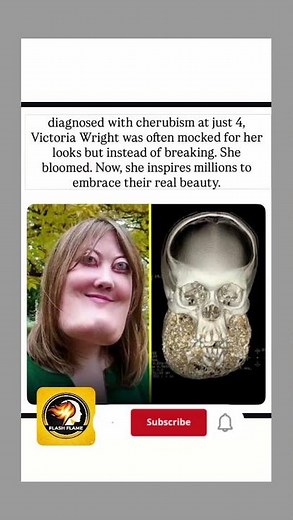 She Turned Her "Bowling Ball" Weight Into Strength | The Story of Victoria Wright