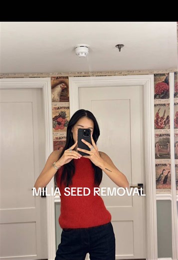 Milia Seed Removal Process and Recovery Tips